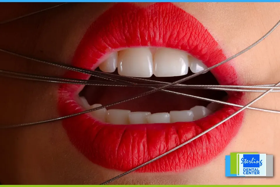 5 Reasons Your Teeth Hurt