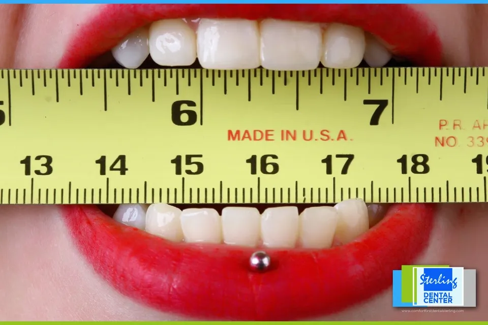 Replace a Tooth - Part 2