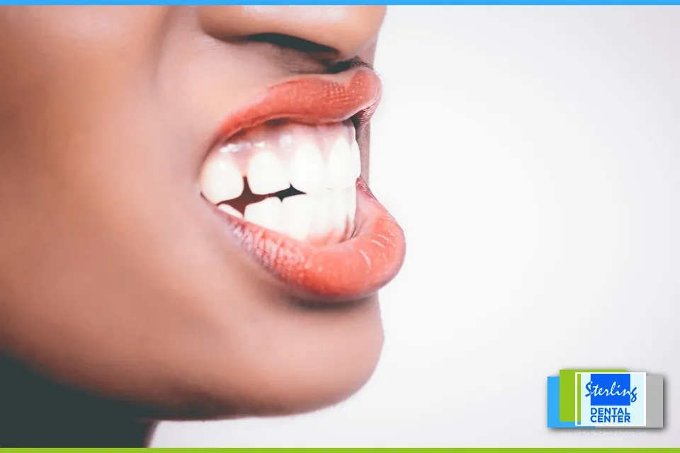 Whiten your teeth