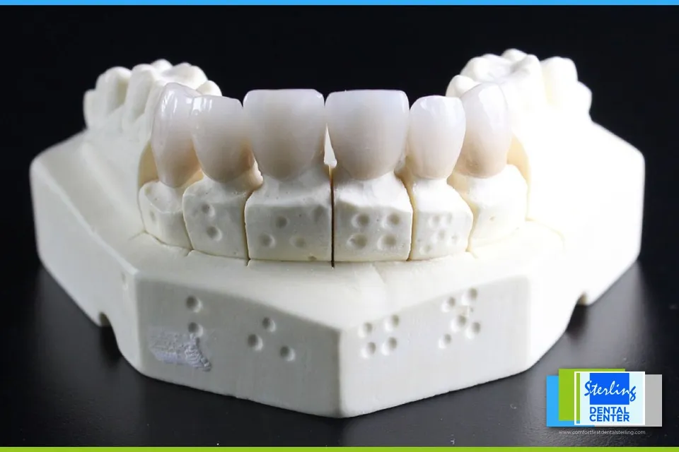 Root canal info