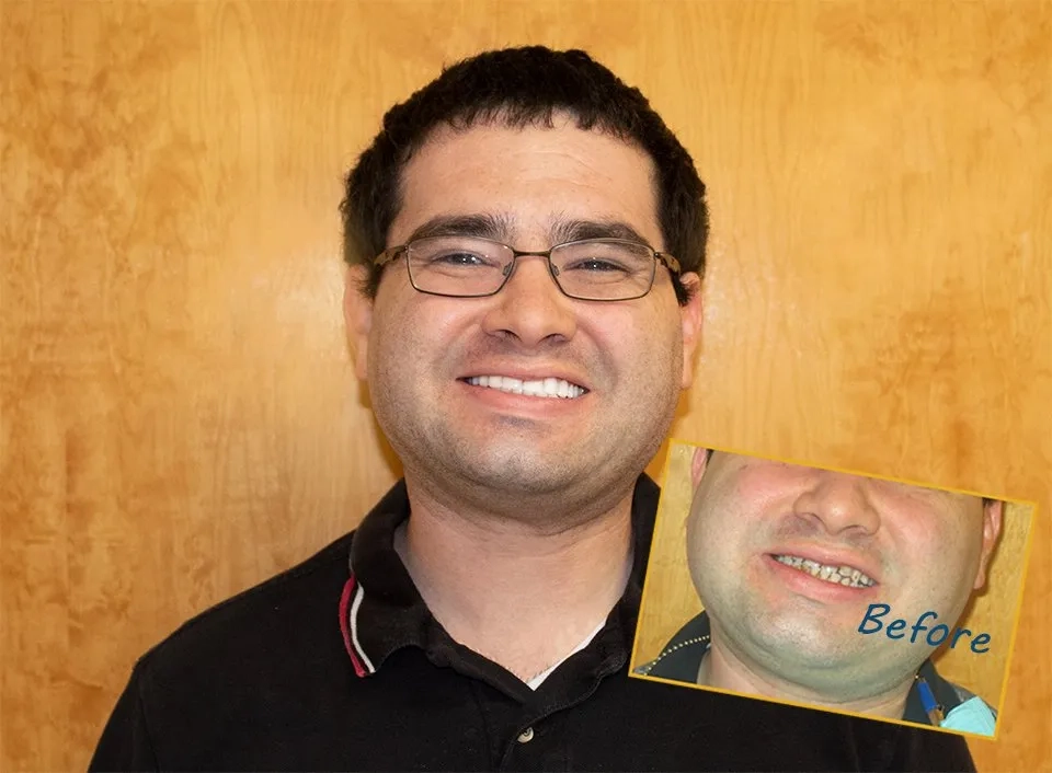 Patient Shares His Thoughts And Experience