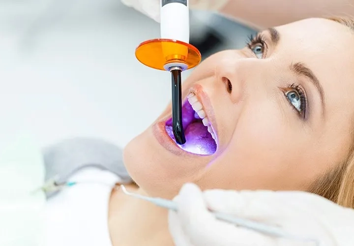 Tooth-Colored Fillings