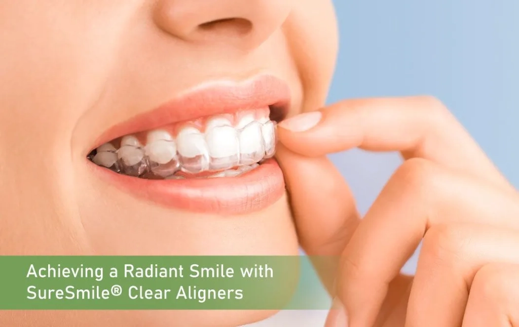 Achieving a Radiant Smile with SureSmile® Clear Aligners
