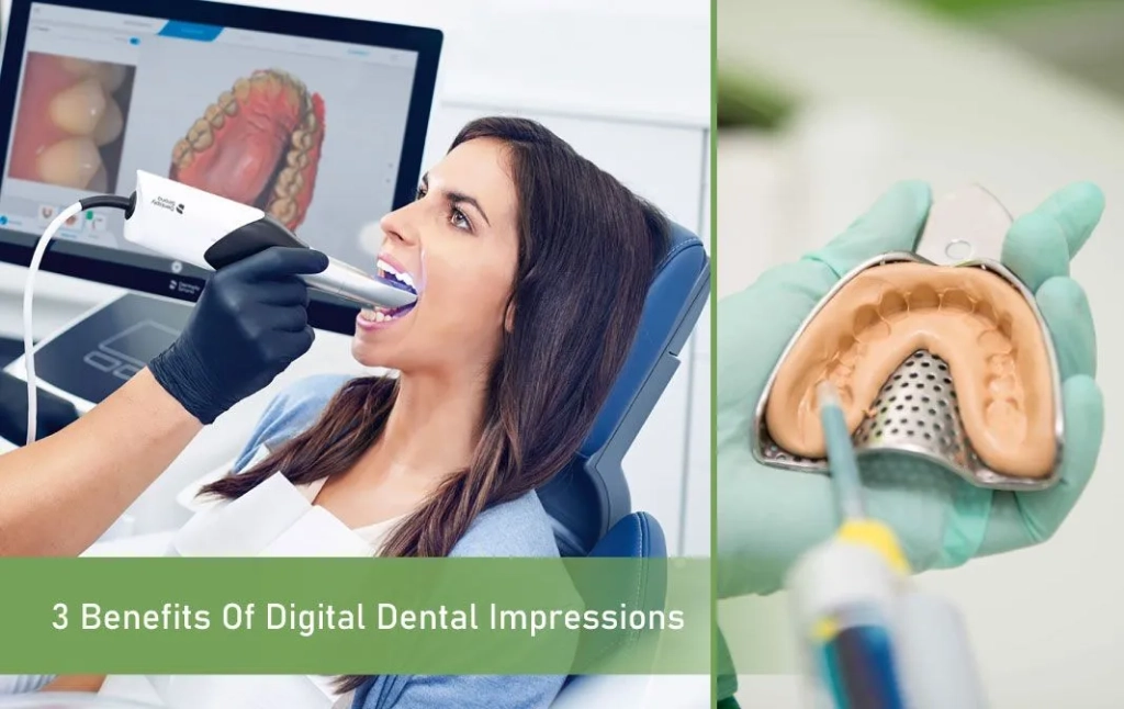 Benefits of Digital Dental Impressions