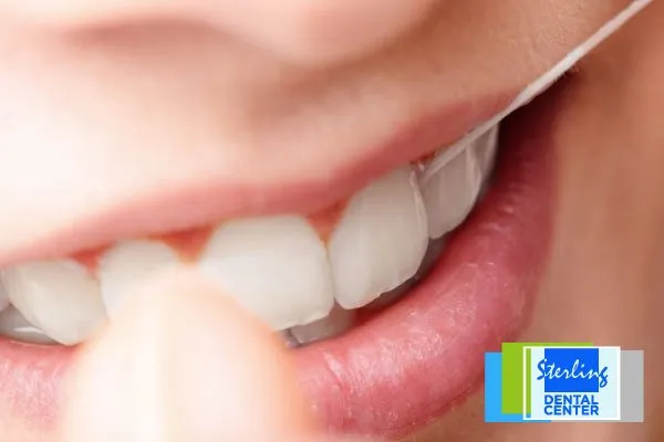 Dental Tip One Flossing