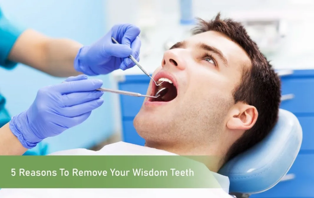 Remove Your Wisdom Teeth