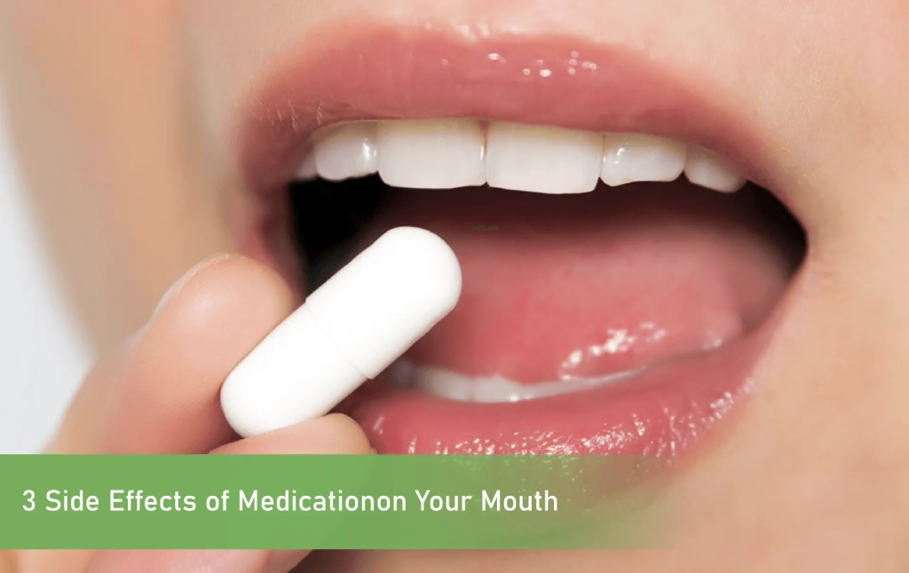 Medication on Your Mouth