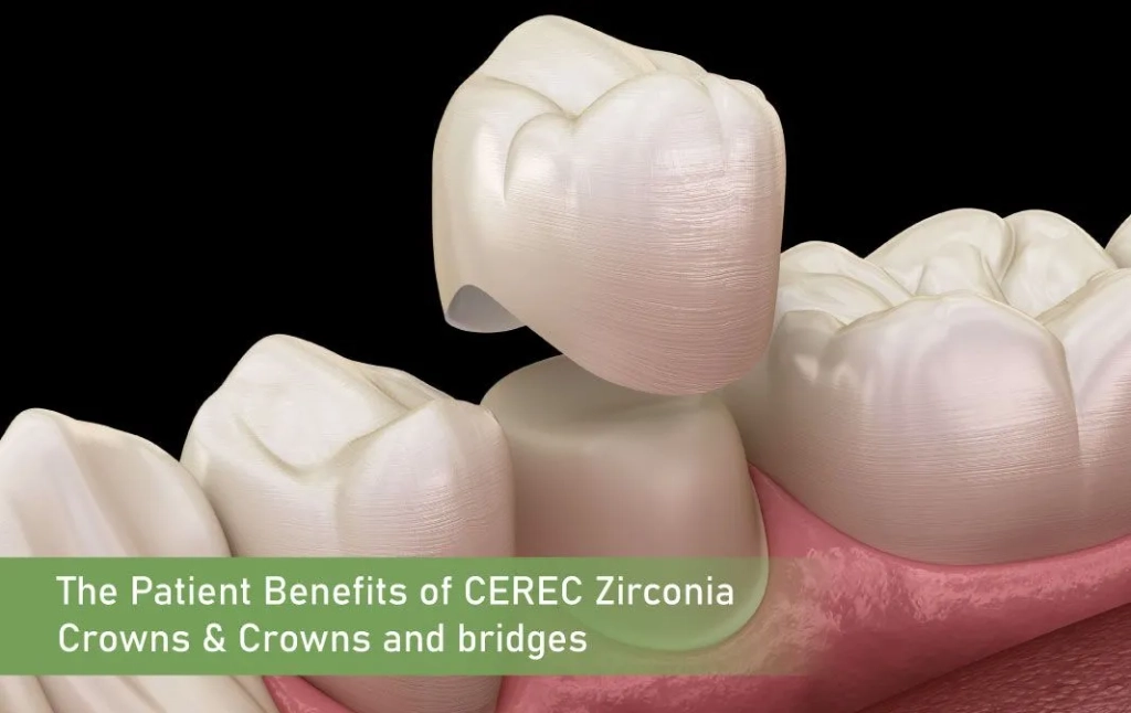 The Patient Benefits of CEREC Zirconia Crowns