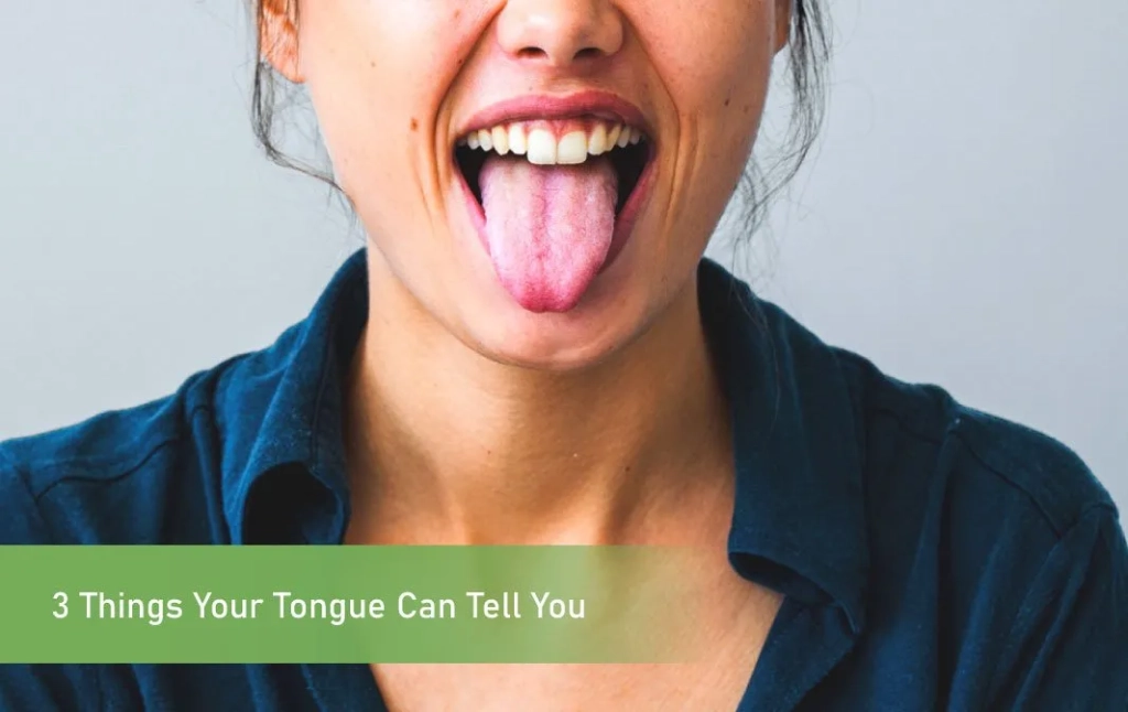 Your Tongue Can Tell You