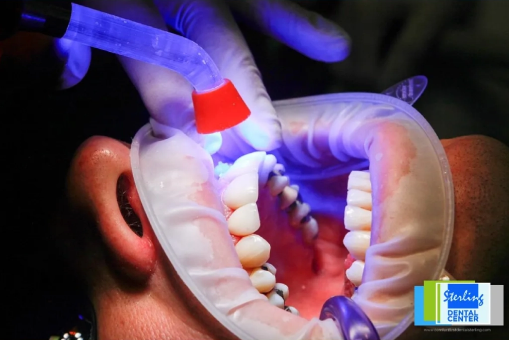 How Do Dental Implants Work?
