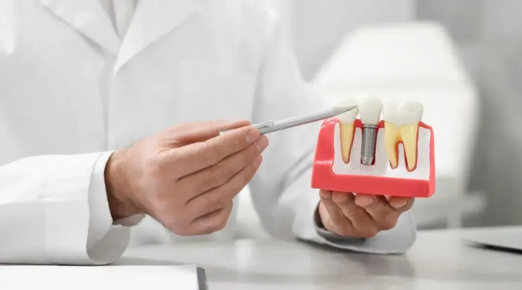Understanding Dental Implants: Are They Right for You