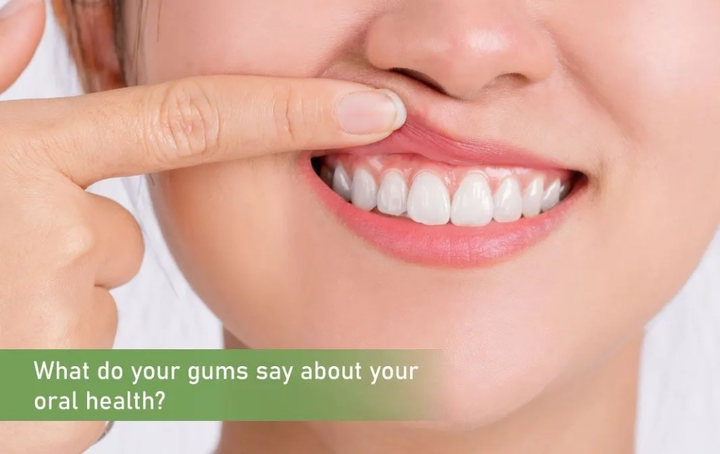 What Do Your Gums Say About Your Oral Health